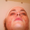 Post Op 10/09/12