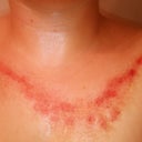 Post op 10/09/12