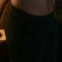 Wk 6- Post op TT