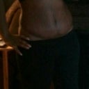 Wk 6- Post op TT