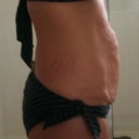 3/24/2011 side - before