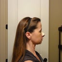 Side view, 3 days postop.  Swollen.  Not cute!