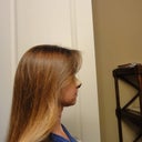 Side view 8 days postop.