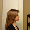 Side view 9 days postop.  The worst is over!