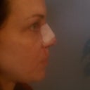 NEW NOSE! yay...i think.