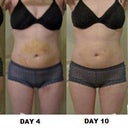 before and after over 3 weeks - Front view