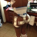 This is where the triangle needs to be. You do not tape it, you just slide it in your garment. Dr. J tapes it to you after surgery but it in the preoperative and postoperative packet it says after the first garment change do not tape the triangle to your body just slide it in garment.