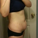 before side view