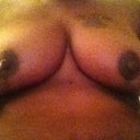 34 days after surgery