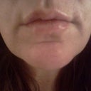 1 day after..so happy