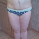 2 months pre-op