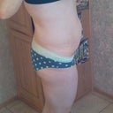 2 months pre-op