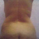 Back Side Before