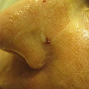 These are some of the blood spots that appeared - then quickly disappeared.
