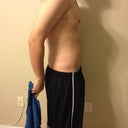 One day after Smart lipo.