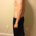 One day after Smart lipo.