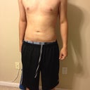 One day after Smart lipo.