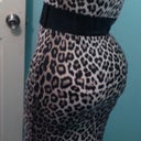 round 2 - 5 months post op back view