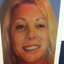 This is me holding a "before" photo that the clinic took of me.