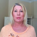 Day 6. Still very pink, still swollen, but heavy makeup allows me to go out in public for the first time.