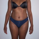 picture of lisalopes before. one of campos's patient.