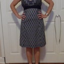 post op day 24. Me in my new halter dress! Unimaginable before this surgery - the weight on my neck would have had me bent double in about 20 mins.
