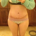 3.5 weeks full incision, very thin