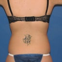 Before- Back