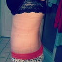 left side @ four weeks... is this really me??