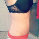 right side @ four weeks