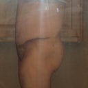 19 days post op left side