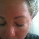 Morning of Day 2, still red and more Puffy