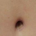 Close up of my bb!  Scar has really faded, this was 2 weeks ago, you can actually barely see it now!