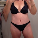 post-op 3weeks
