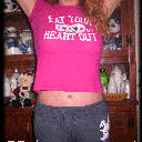 57 days post op :)