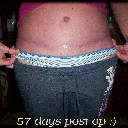 57 days post op :)
