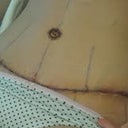 Day after surgery