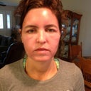 Day 3...swollen