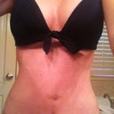 4 weeks post op