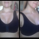 3 weeks post op wearing sports bra