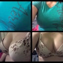 1 month post op wearing 34 DD bra. I think it might be too big cuz it gaps on top but its a VS measuremnt