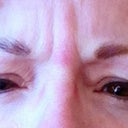 Before, I can squeeze my brows together and squint and frown -