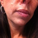 This is the before pic. Anyone had something similar done?