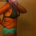 Three weeks post op