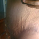 right side scar is looking awesome