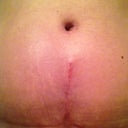 See how long it really is?  That's what used to be my belly button. Ugh. It's supposed to flatten out. I hope so!