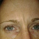March 2013
procedure December 2011