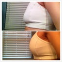 Before/After. Day 6 p/o