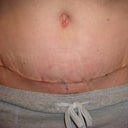 You can see my belly button problem here.....nothing big, but still isn't right.