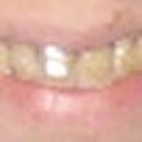 During